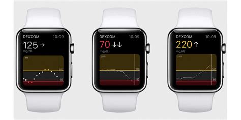 Type 2 since 2004. . Does dexcom g6 work with apple watch without phone